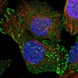 SORBS1 Antibody, Novus Biologicals 0.1mL; Unlabeled:Antibodies, Polyclonal